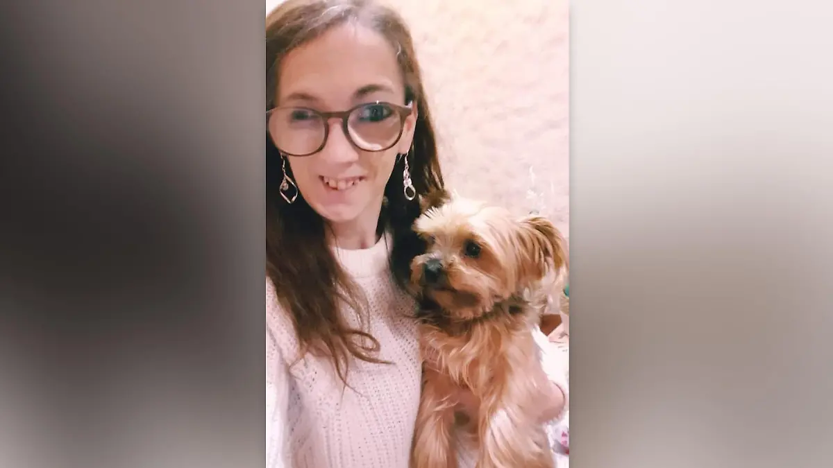 Sabrina Hillermeiers linke Körperhälfte ist kürzer als ihre rechte.