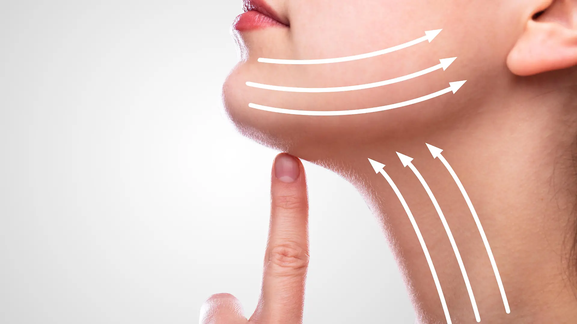 Woman After Face Lifting On Her Face