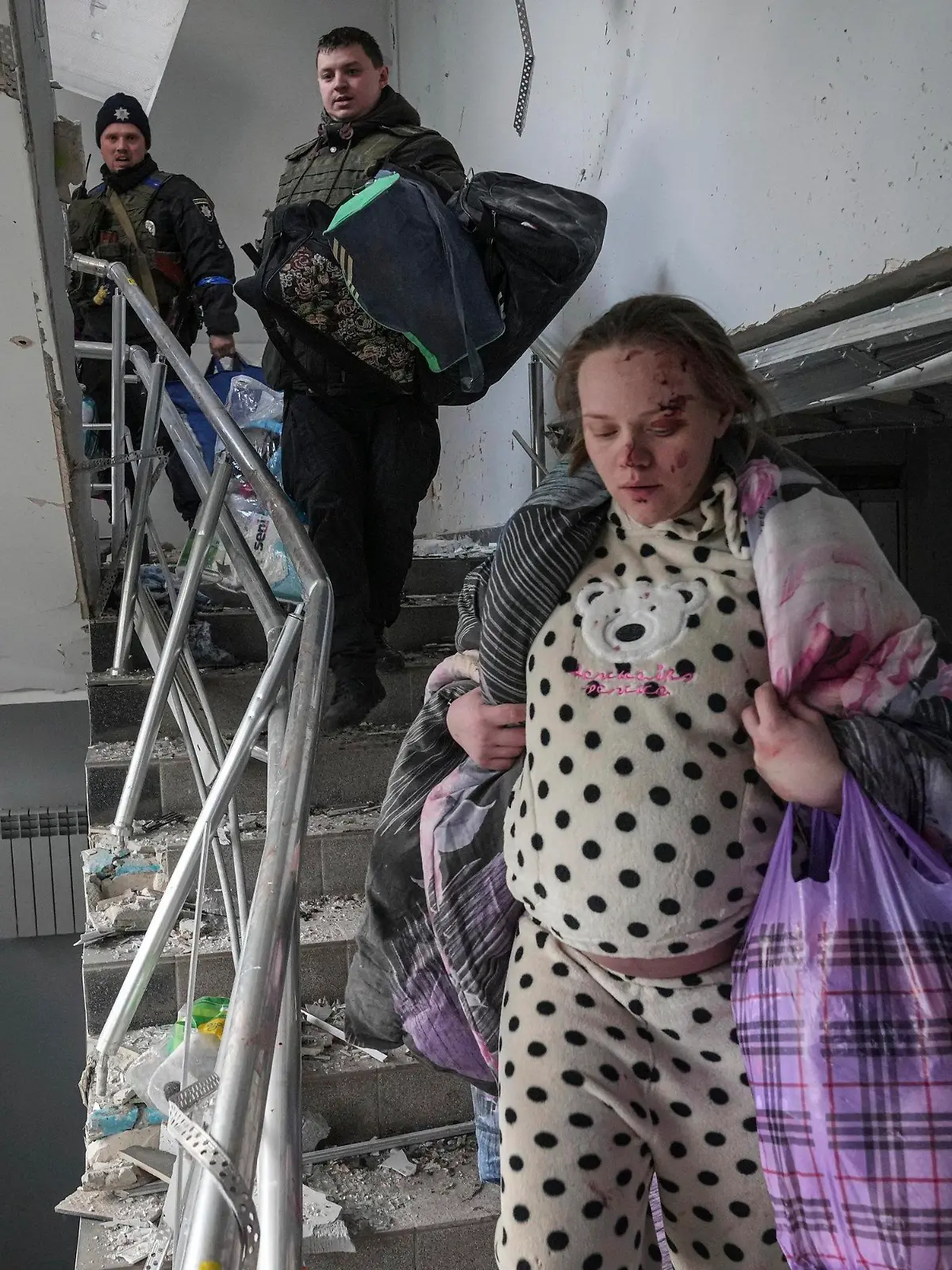 An injured pregnant woman walks downstairs in the damaged by shelling maternity hospital in Mariupol, Ukraine, Wednesday, March 9, 2022. A Russian attack has severely damaged a maternity hospital in the besieged port city of Mariupol, Ukrainian officials say. (AP Photo/Evgeniy Maloletka)