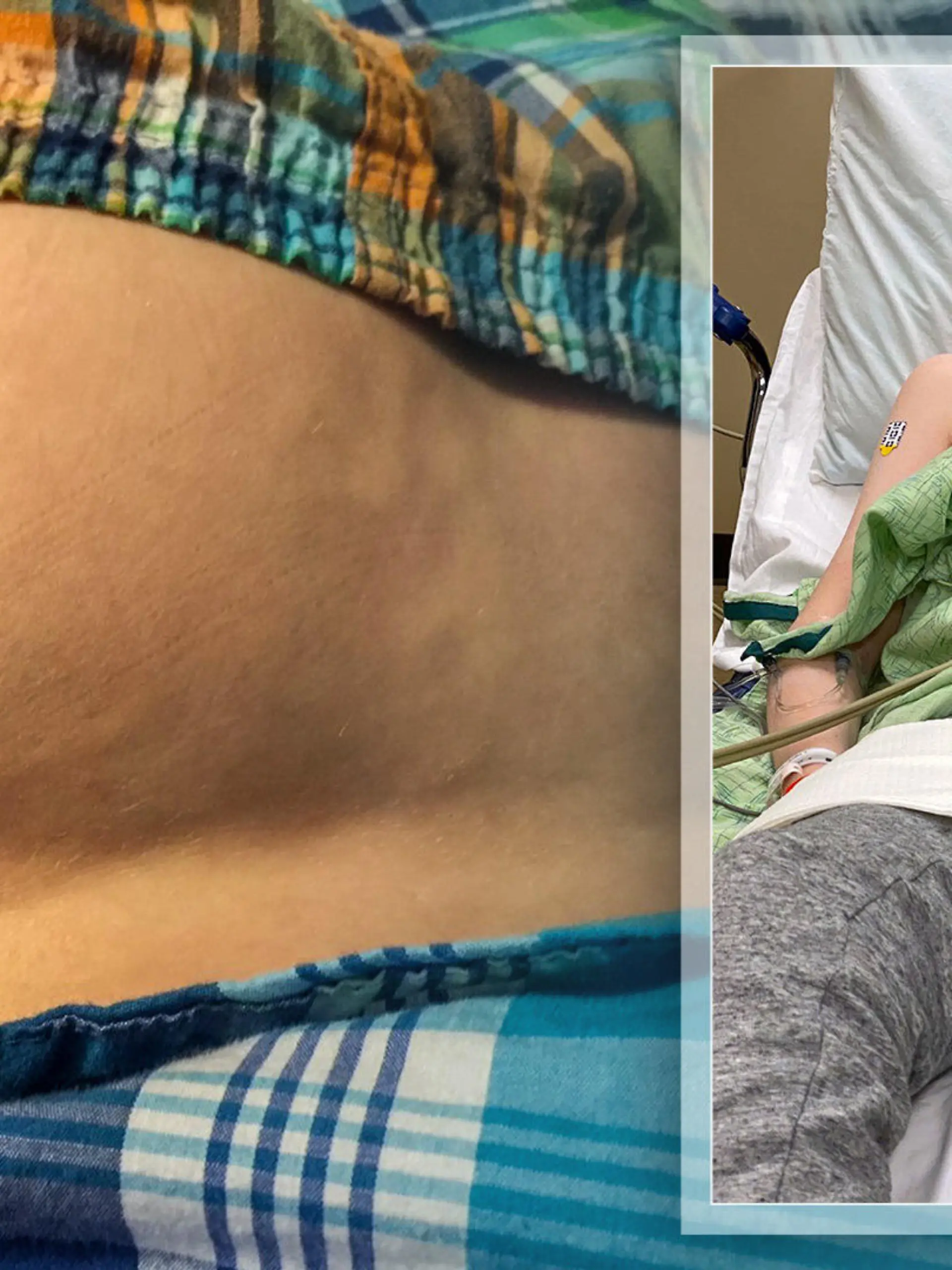 Jaiden Rogers (16) leidet an einer seltenen Krankheit, bei der sein Körper zu Stein wird.