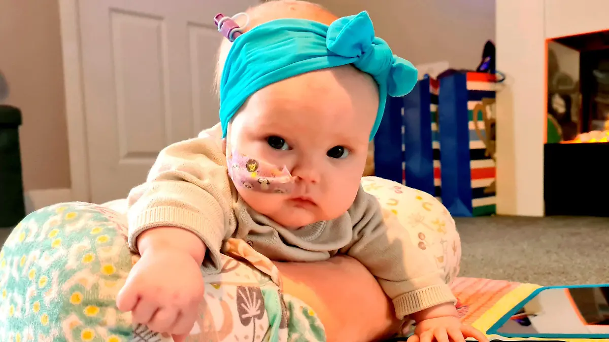 SONDERKONDITIONEN: Satzpreis!
A three-month-old baby?s life has been saved after fluid caused by a tumour in her brain meant that her head size ?had gone off the chart.? See SWNS story SWMDbaby. Molly Mai Wardle-Hampton started suffering from seizures when she was at three-weeks-old and worried mum, Corinne, 37, was told by GP?s that it was ?normal baby stuff.? Doctors had told Corinne to monitor Molly?s situation and check-in with the GP in three-month's time. Sadly, Molly started to develop other symptoms including an enlarged head due to intercranial pressure and that she could one move her eyes in one direction. After Molly's condition rapidly deteriorated last month she took her to the Countess of Chester Hospital's A&E department ? a place where Corinne also works as nurse. There, Molly was blue-lit by ambulance to the Alder Hey Children?s Hospital where a scan proved she had a large brain tumour. Fluid was putting pressure on her brain and doctors were forced to perform emergency surgery to save her life. / action press