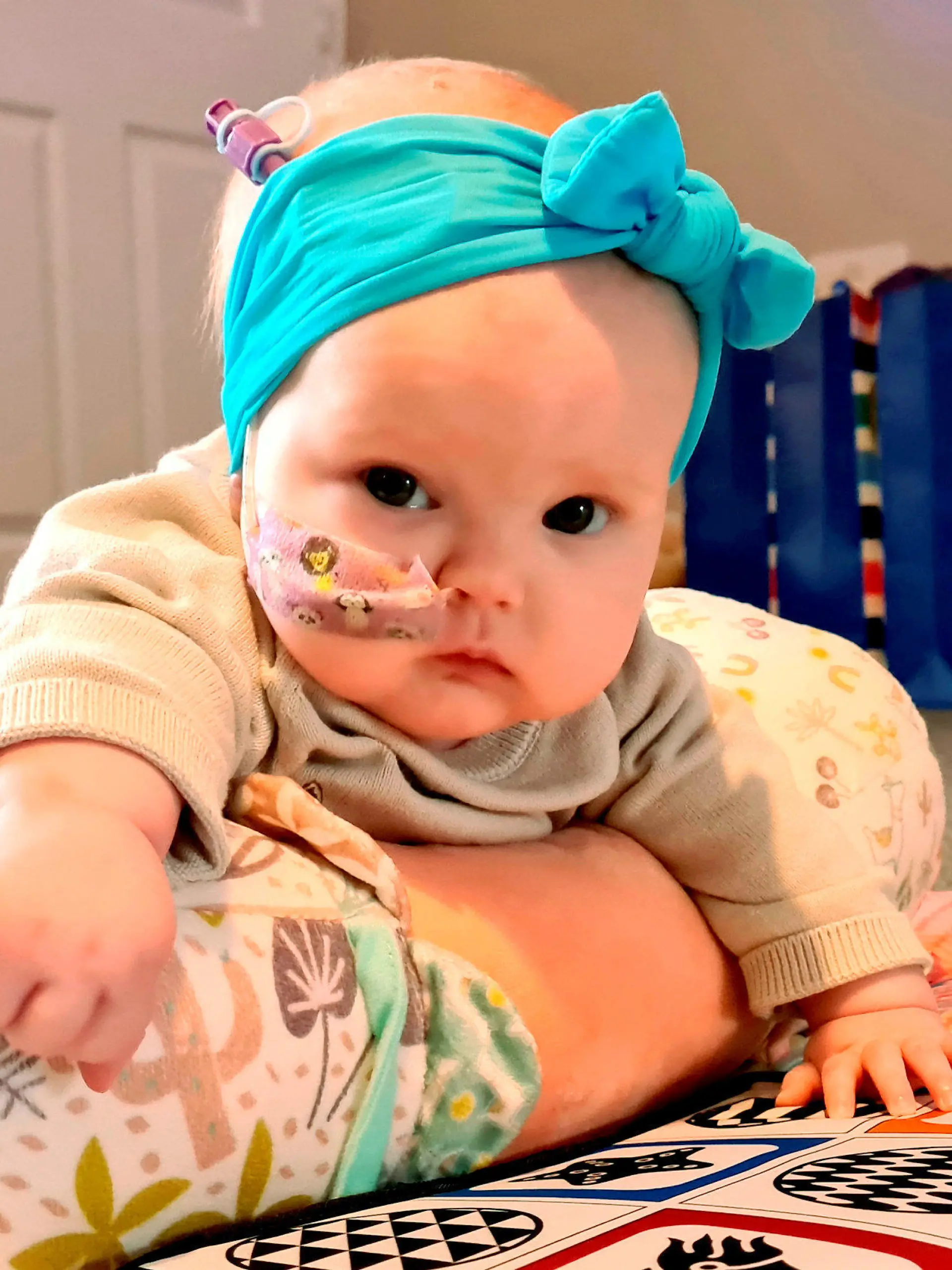 SONDERKONDITIONEN: Satzpreis!
A three-month-old baby?s life has been saved after fluid caused by a tumour in her brain meant that her head size ?had gone off the chart.?  See SWNS story SWMDbaby.  Molly Mai Wardle-Hampton started suffering from seizures when she was at three-weeks-old and worried mum, Corinne, 37, was told by GP?s that it was ?normal baby stuff.?  Doctors had told Corinne to monitor Molly?s situation and check-in with the GP in three-month's time. Sadly, Molly started to develop other symptoms including an enlarged head due to intercranial pressure and that she could one move her eyes in one direction. After Molly's condition rapidly deteriorated last month she took her to the Countess of Chester Hospital's A&E department ? a place where Corinne also works as nurse. There, Molly was blue-lit by ambulance to the Alder Hey Children?s Hospital where a scan proved she had a large brain tumour. Fluid was putting pressure on her brain and doctors were forced to perform emergency surgery to save her life.  / action press