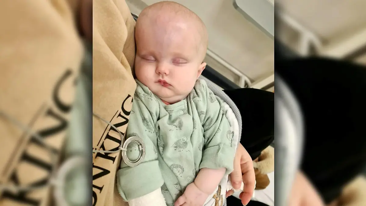 Molly in den Armen ihrer Mutter. Ihr Kopf ist durch einen Tumor extrem angeschwollen.
