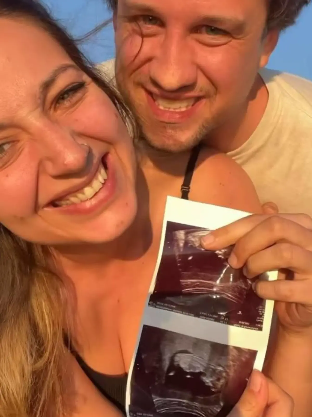 Hannah Kerschbaumer und ihr Mann Chris werden erstmals Eltern.