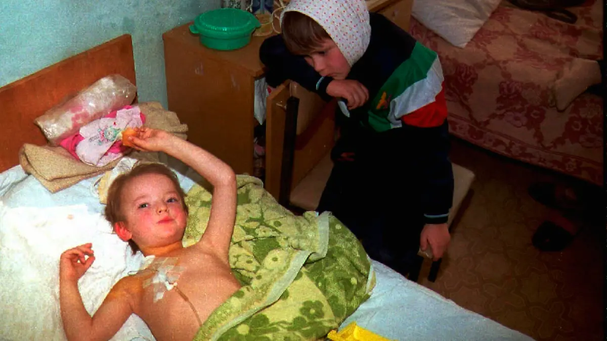Ein krebskrankes Mädchen (r) betrachtet am 23.4.1996 in der Kinder-Krebsstation einer Spezialklinik in Kiew seinen Leidensgenossen, einen kleinen Jungen. Zehn Jahre nach dem Reaktorunglück in Tschernobyl ist das Ausmaß der gesundheitlichen Schäden noch nicht abzusehen. Doch allein die Fälle von Schilddrüsenkrebs bei Kindern haben sich in der Ukraine und Weißrußland seit dem Reaktorunglück versechzigfacht. Angeblich erkranken in der Ukraine jedes Jahr 2000 Kinder an Krebs.