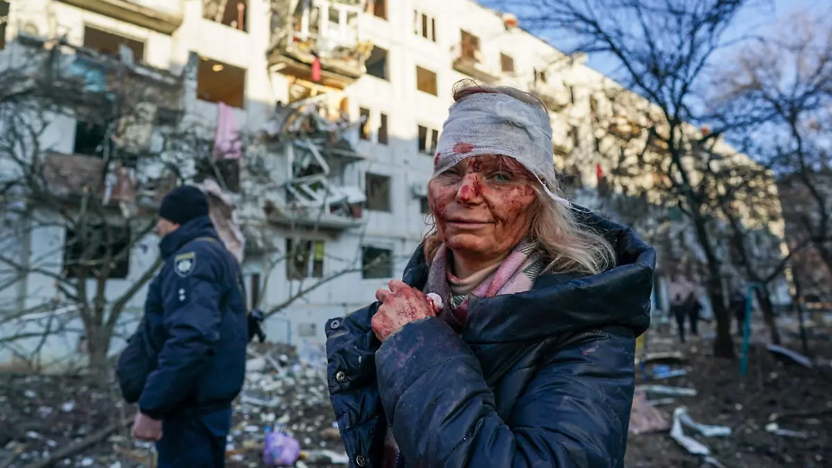 CHUHUIV, UKRAINE - FEBRUARY 24: (EDITORS NOTE: Image depicts graphic content) A wounded woman is seen after an airstrike damaged an apartment complex in city of Chuhuiv, Kharkiv Oblast, Ukraine on February 24, 2022. Wolfgang Schwan / Anadolu Agency