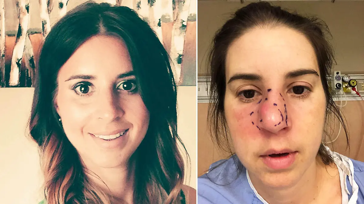 Trish Hawley bemerkt eines Tages, dass ihre Nase ungewöhnlich stark schmerzt. Die Diagnose: Tumor.