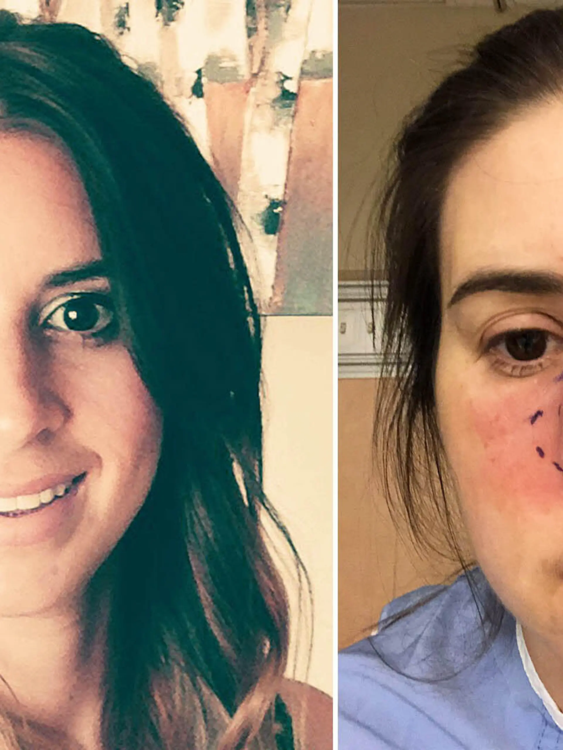 Trish Hawley bemerkt eines Tages, dass ihre Nase ungewöhnlich stark schmerzt. Die Diagnose: Tumor.