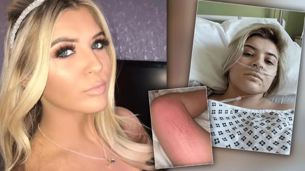 April Grierson vor und nach ihrer Diagnose