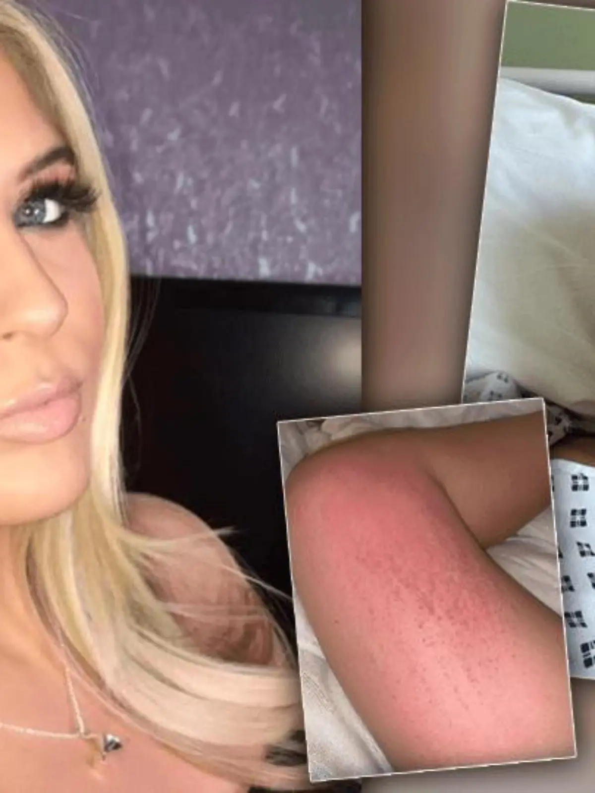 April Grierson vor und nach ihrer Diagnose