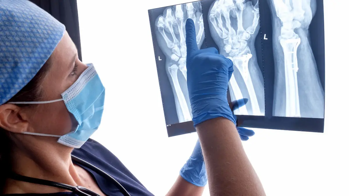 Orthopedic surgeon studying a x-ray of a broken radius bone in theater after correctional surgery.