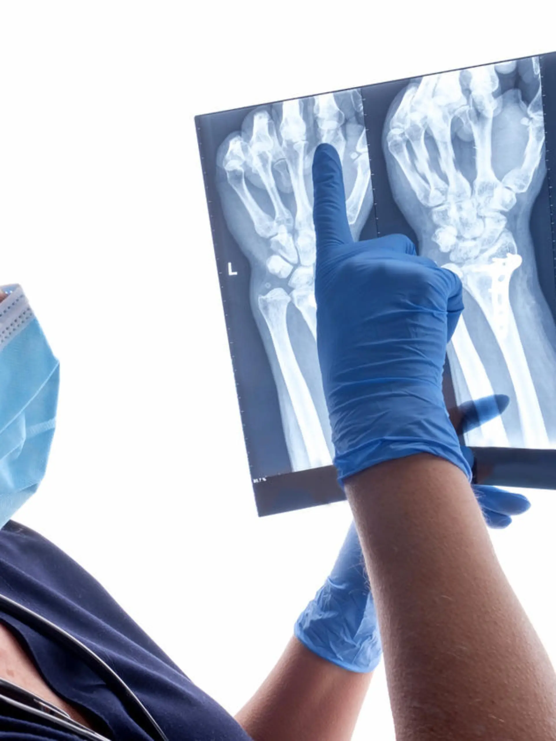Orthopedic surgeon studying a x-ray of a broken radius bone in theater after correctional surgery.