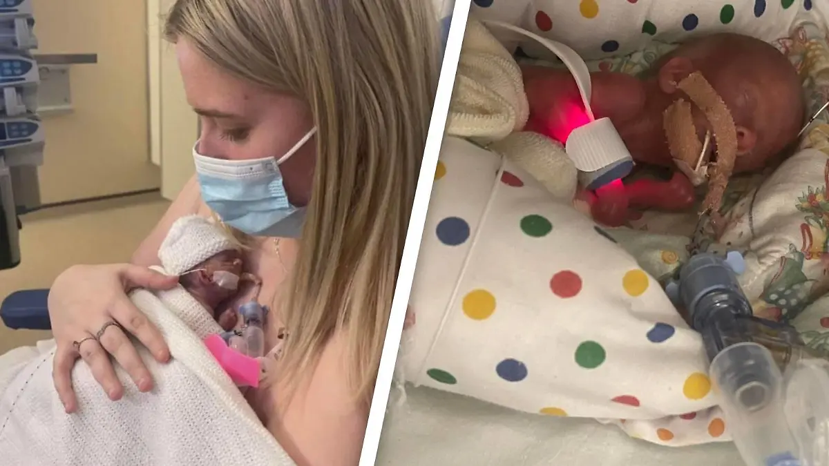 Mama Ellie Paton ist überglücklich, als sie ihre Tochter Hannah nach Wochen im Brutkasten zum ersten Mal im Arm halten darf.