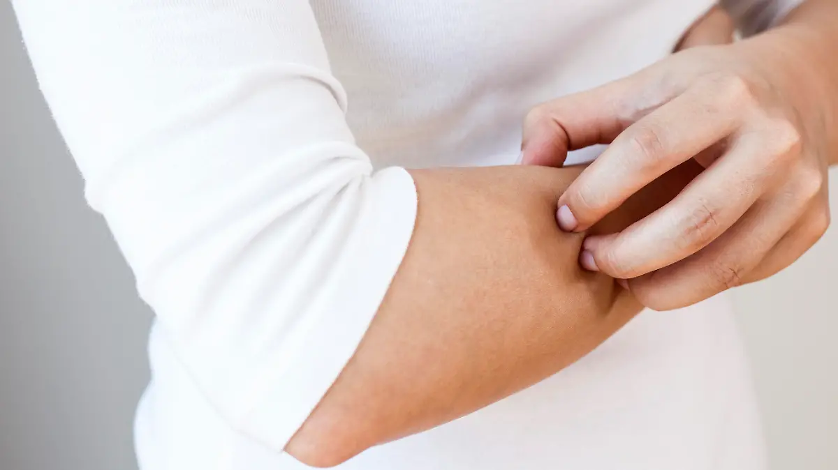 Caucasian woman is scratching her arm. Torso of woman with white shirt and jeans is shown under natural light, horizontal