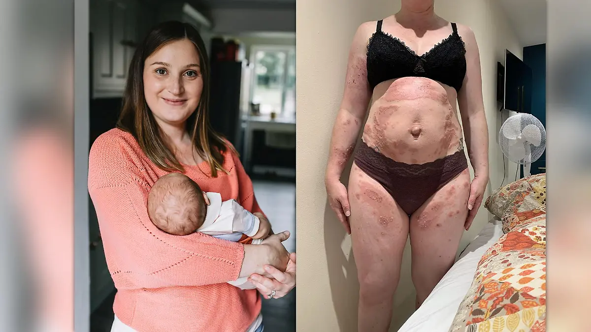 Fiona Hooker mit ihrem kleinen Sohn, auf den ihr Körper allergisch reagiert.
