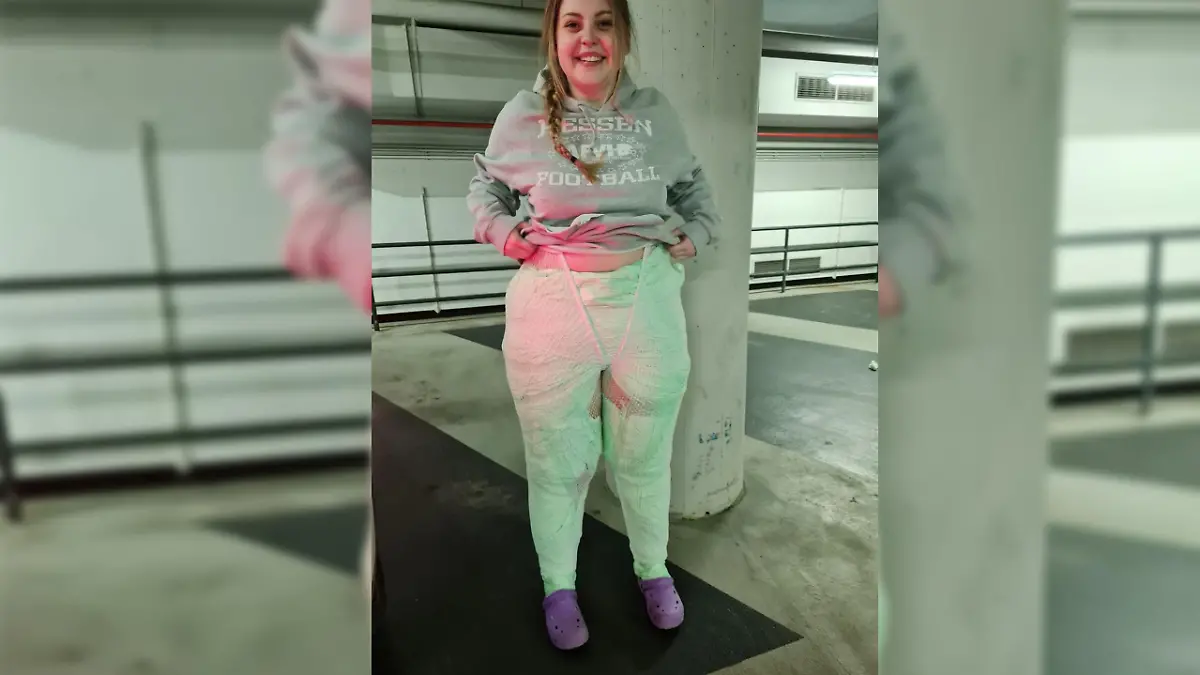 Kimberly direkt nach der ersten Operation.