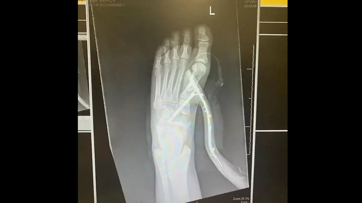 Die junge Frau musste sofort im Krankenhaus behandelt werden.