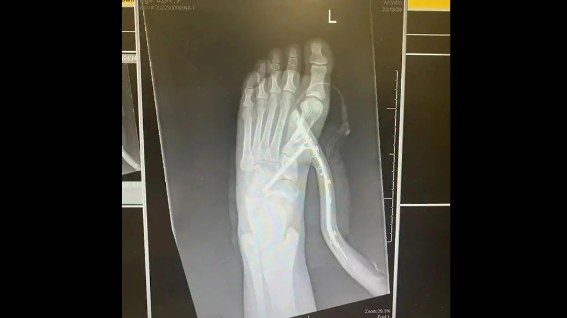 Die junge Frau musste sofort im Krankenhaus behandelt werden.