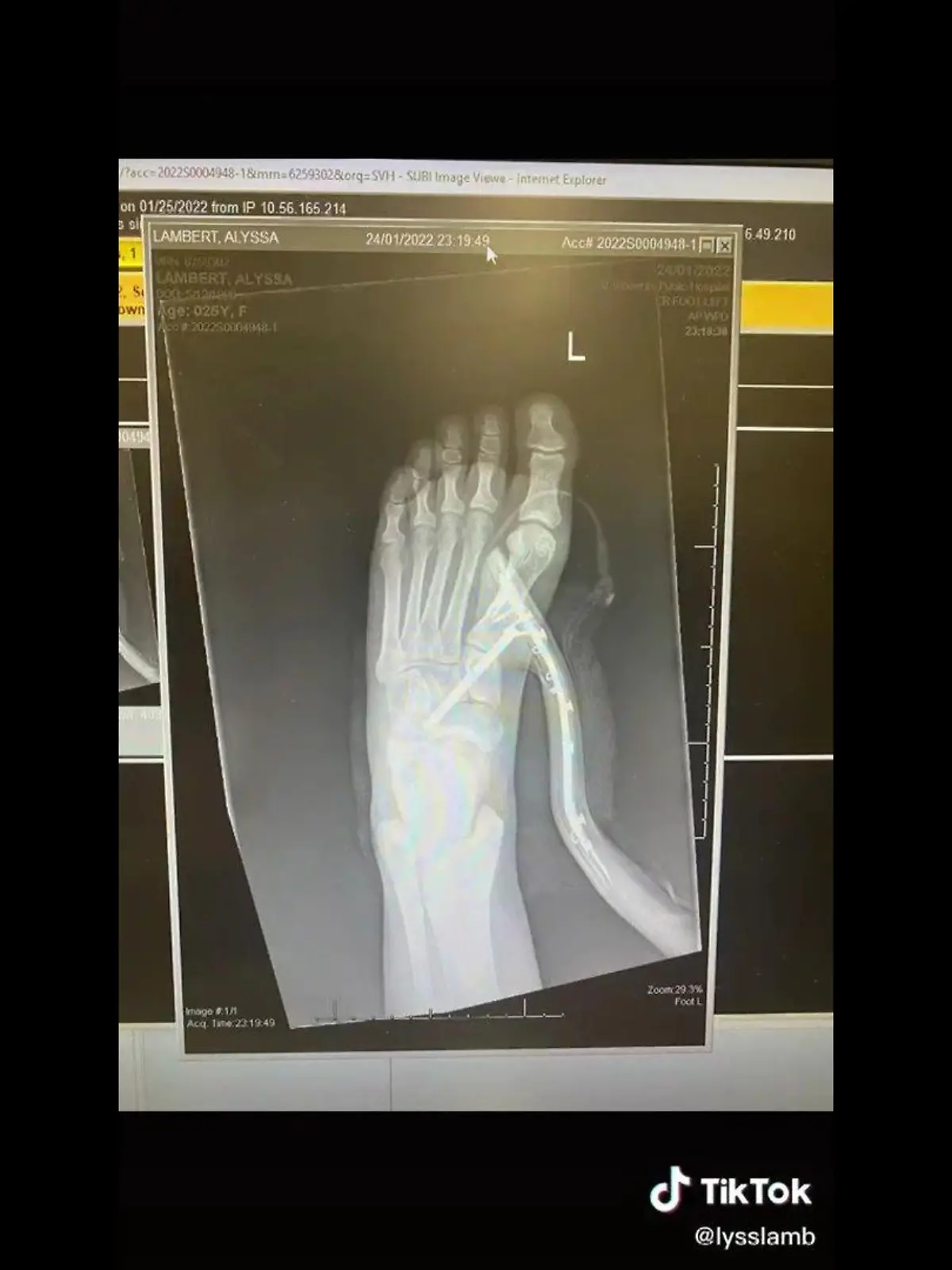 Die junge Frau musste sofort im Krankenhaus behandelt werden.