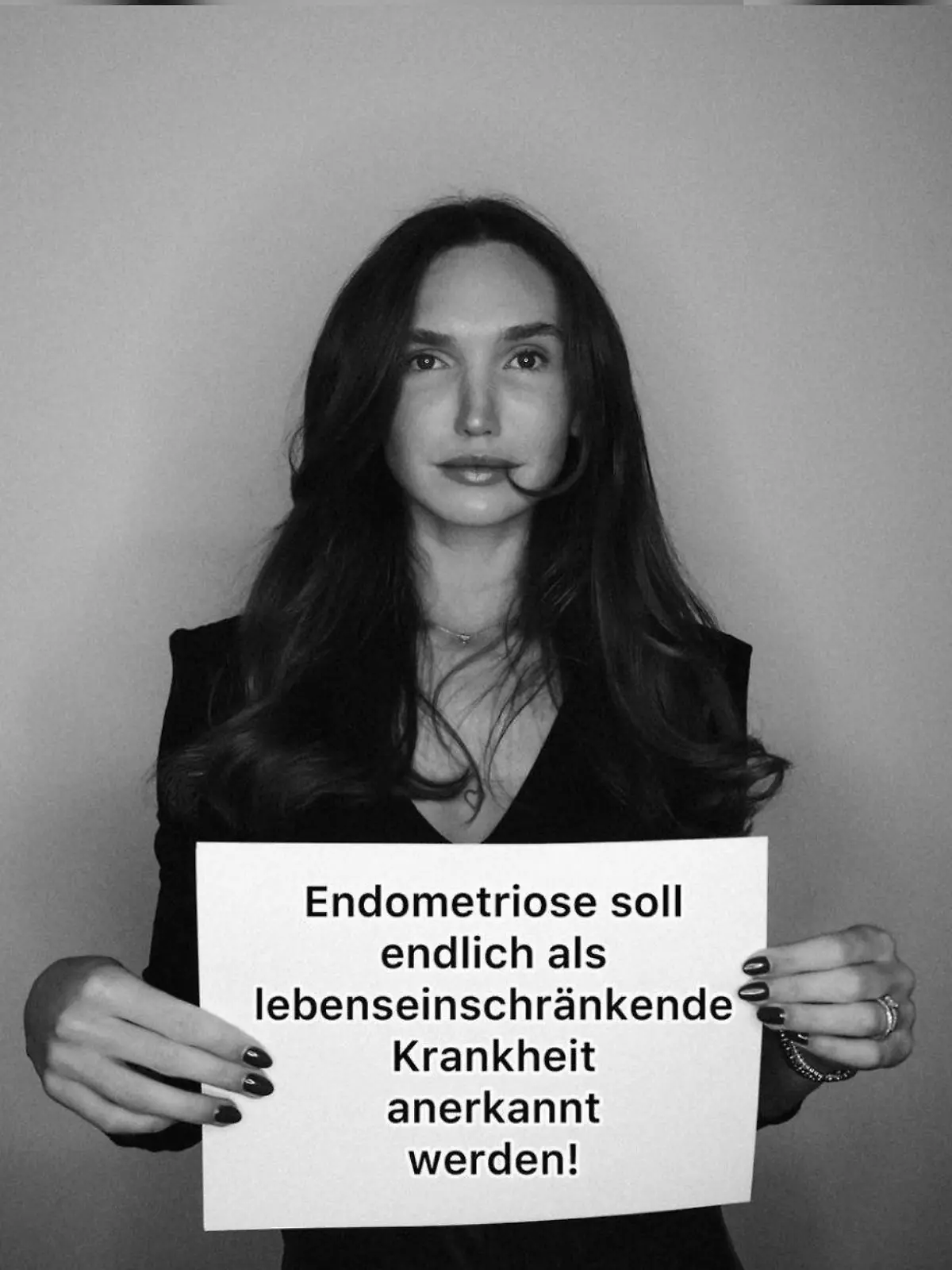 Die ehemalige GNTM-Kandidatin möchte auf die Krankheit aufmerksam machen