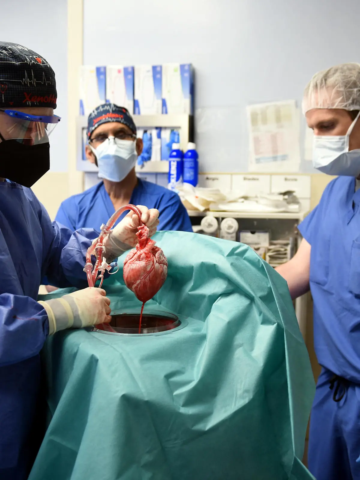 Surgeon Muhammad M. Mohiuddin, MD leads a team placing a genetically-modified pig heart into a storage device at the Xenotransplant lab before its transplant on David Bennett, a 57-year-old patient with terminal heart disease, at University of Maryland Medical Center in Baltimore, Maryland, U.S. January 7, 2022. Picture taken January 7, 2022.  University of Maryland School of Medicine (UMSOM)/Handout via REUTERS.  NO RESALES. NO ARCHIVES. THIS IMAGE HAS BEEN SUPPLIED BY A THIRD PARTY. MANDATORY CREDIT