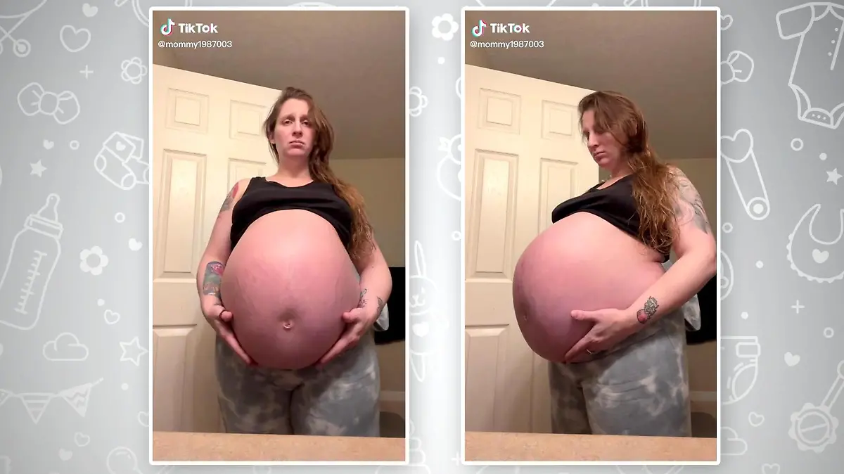 Babybauch