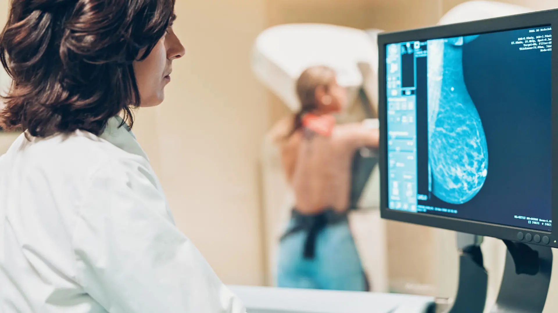 Doctor and patient making a mammography