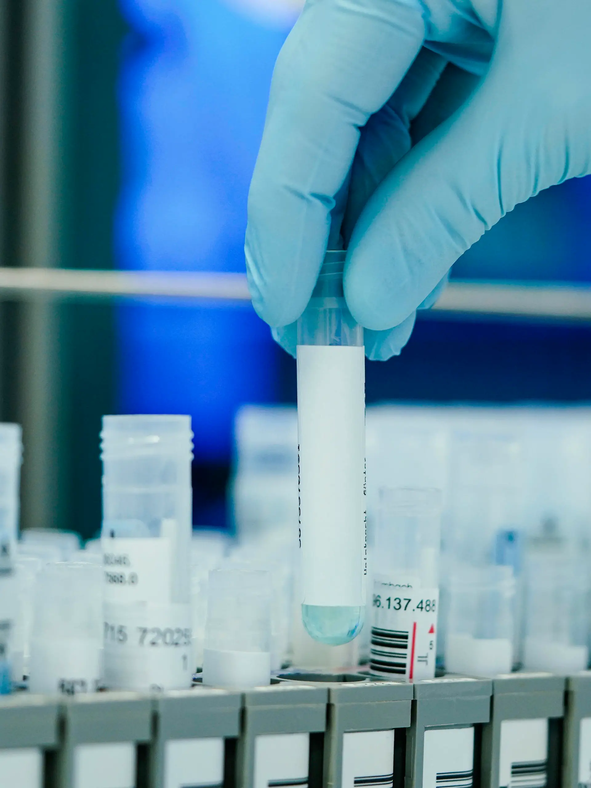 13.01.2022, Baden-Württemberg, Heidelberg: Ein Mitarbeiter hält in einem Coronatest-Labor der Limbach Gruppe PCR-Teströhrchen in den Händen. Aufgrund von steigenden Omikron-Infektionszahlen droht in den Coronatest-Laboren im Südwesten das Personal knapp zu werden. Foto: Uwe Anspach/dpa +++ dpa-Bildfunk +++