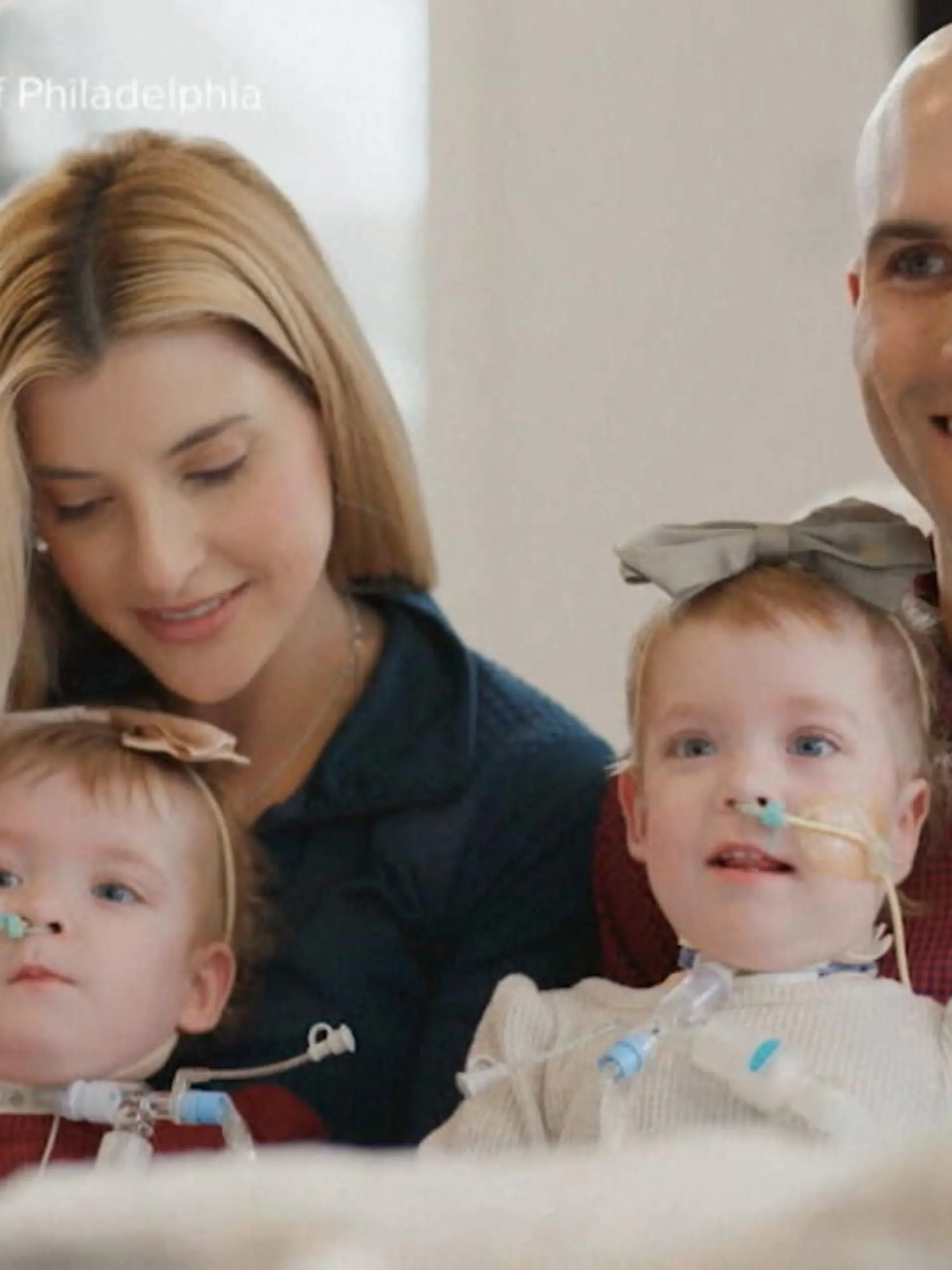 Eigentlich sollte es ein Routine-Termin werde: Bei einem Ultraschall rund 20 Wochen vor der Geburt erfahren Maggie und Dom Altobelli, dass ihre Zwillinge Addy und Lilly an der Brust miteinander verbunden sind.