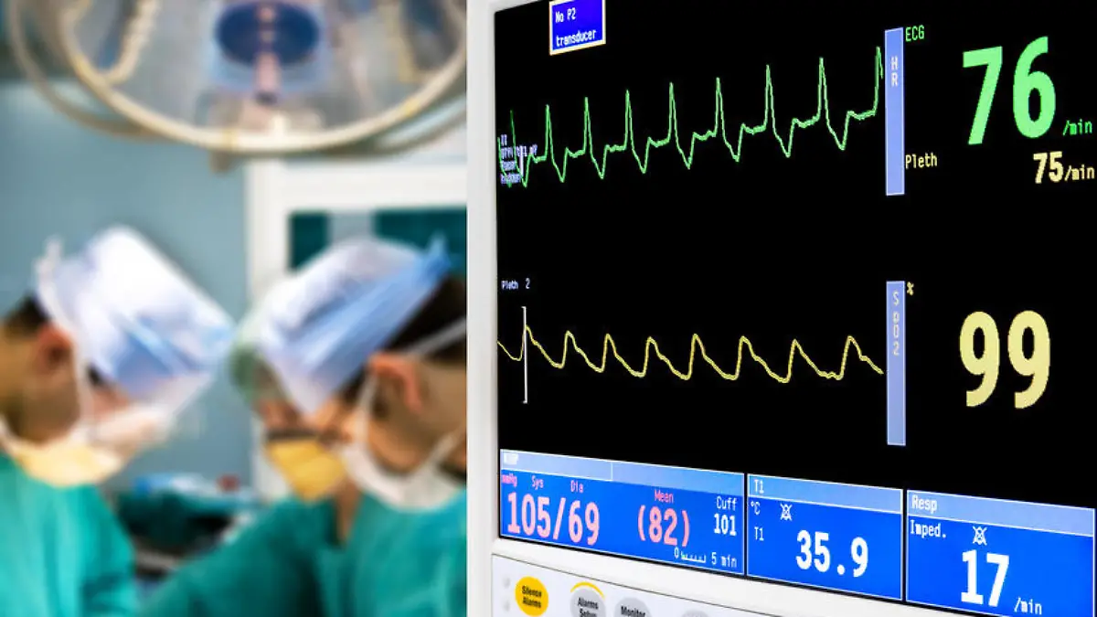 patient cardiogram monitoring in operation room