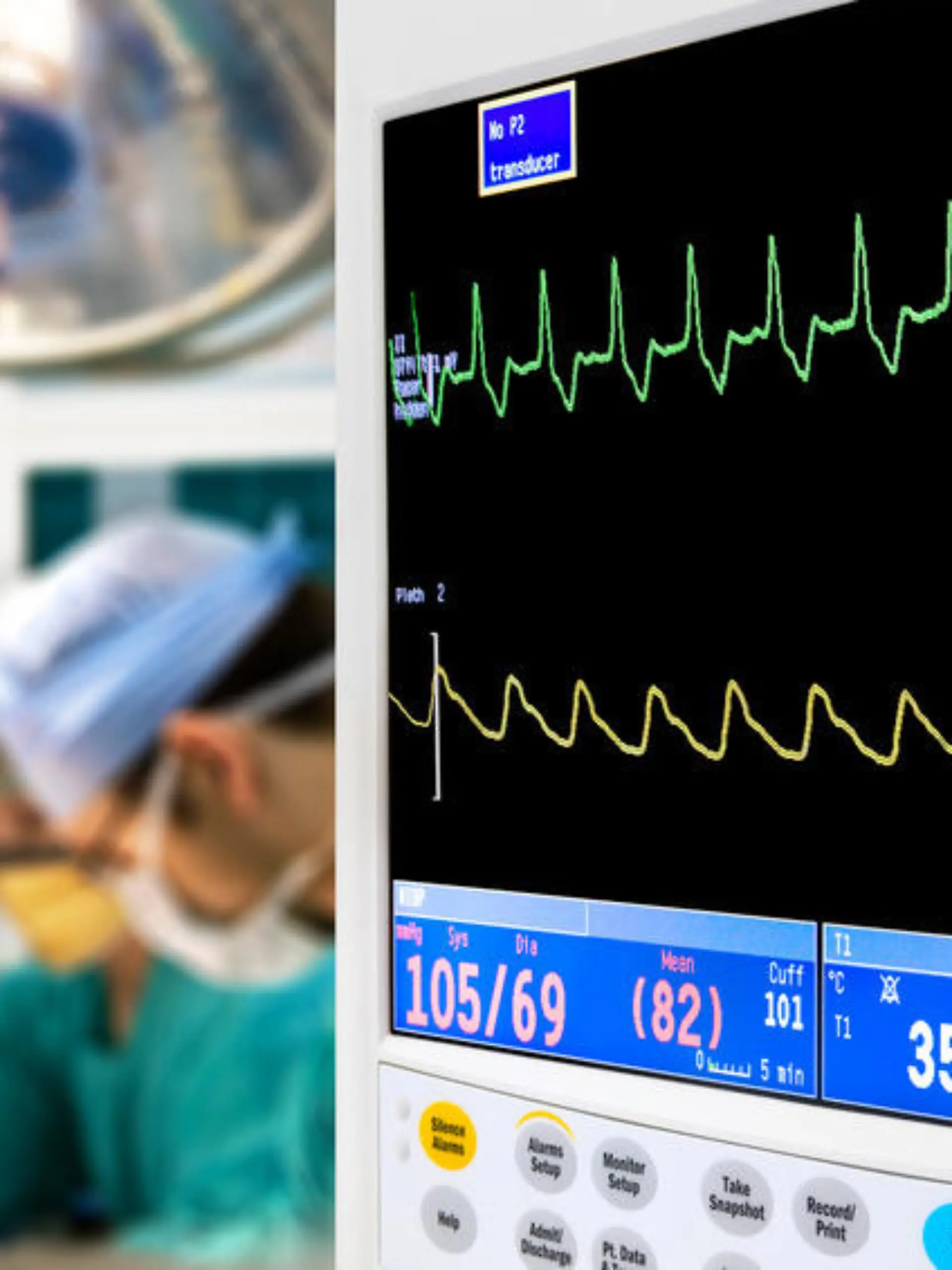 patient cardiogram monitoring in operation room