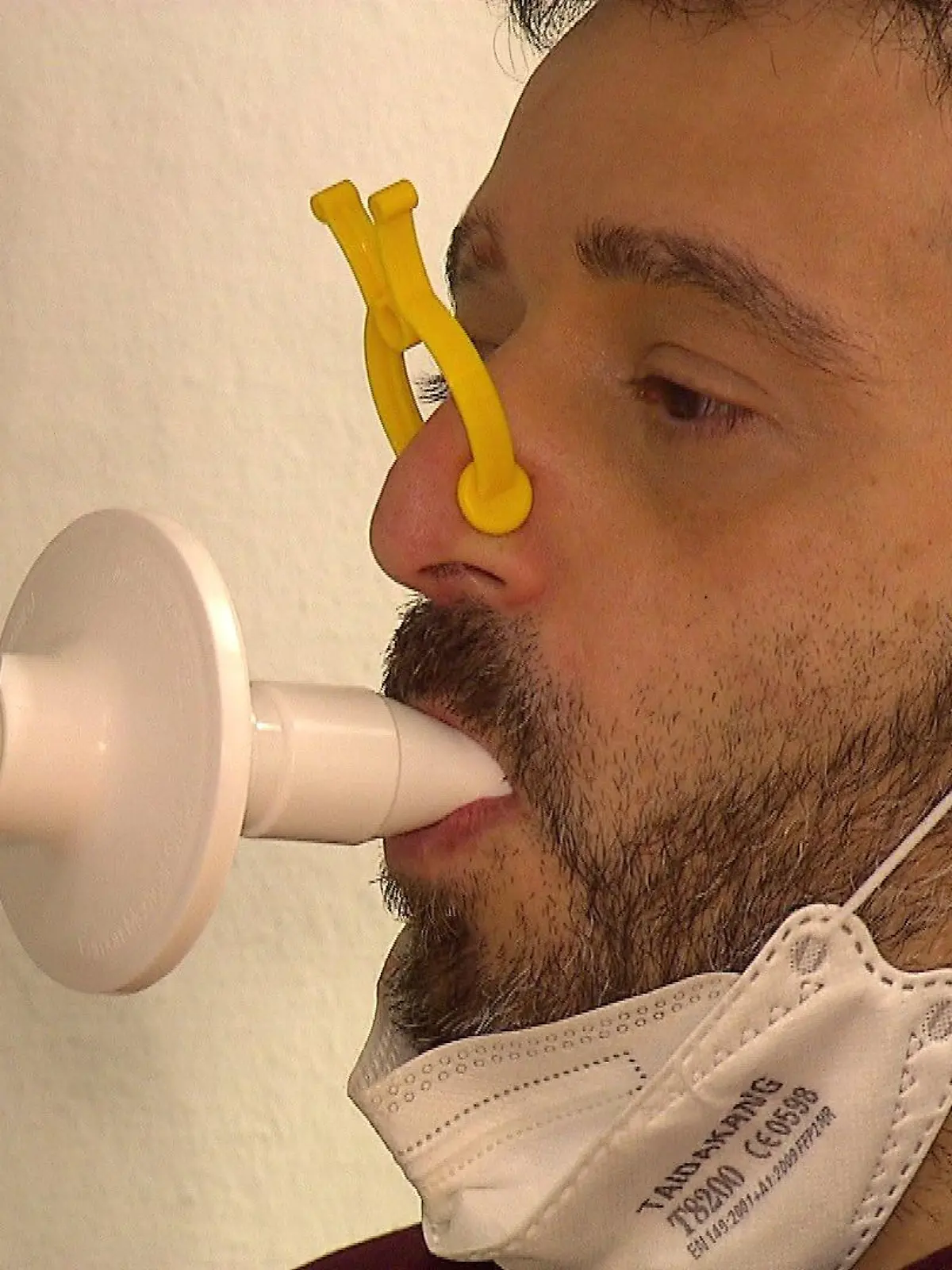 Luigi Dirma muss regelmäßig den Zustand seiner Lunge überprüfen lassen.