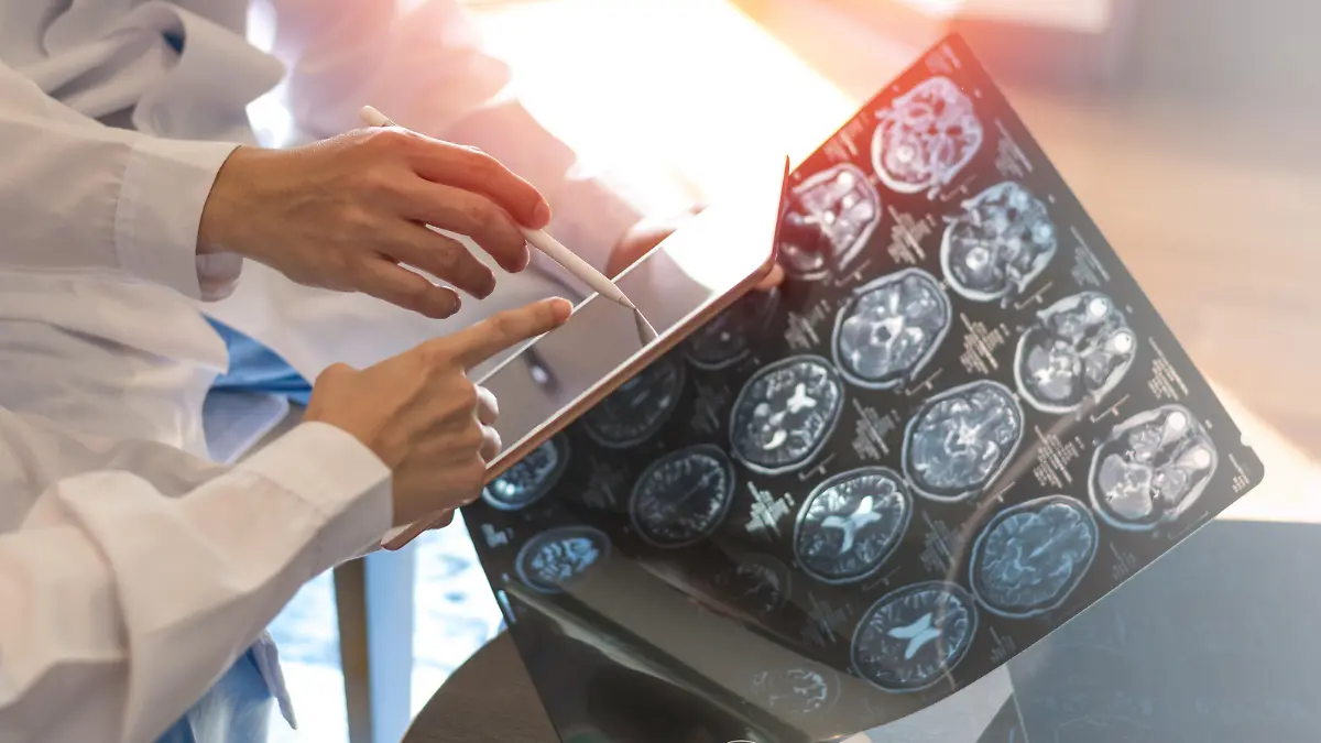 Ein Neurologe untersucht das Gehirn eines Patienten.