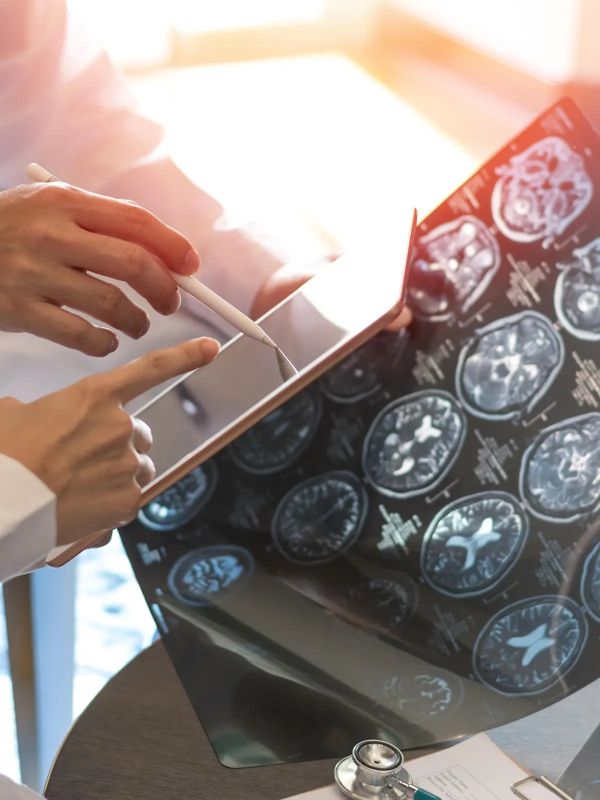 Ein Neurologe untersucht das Gehirn eines Patienten.