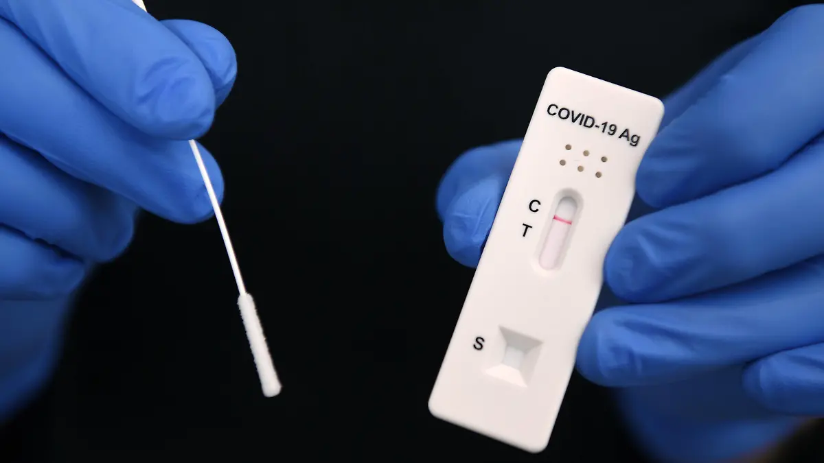  Tuebingen 03.12.2020 Symbolbild: Negativer SARS-CoV-2 Rapid Antigen Schnelltest und Tupfer *** Tuebingen 03 12 2020 Symbol image Negative SARS CoV 2 Rapid Antigen Rapid test and swab ULMER