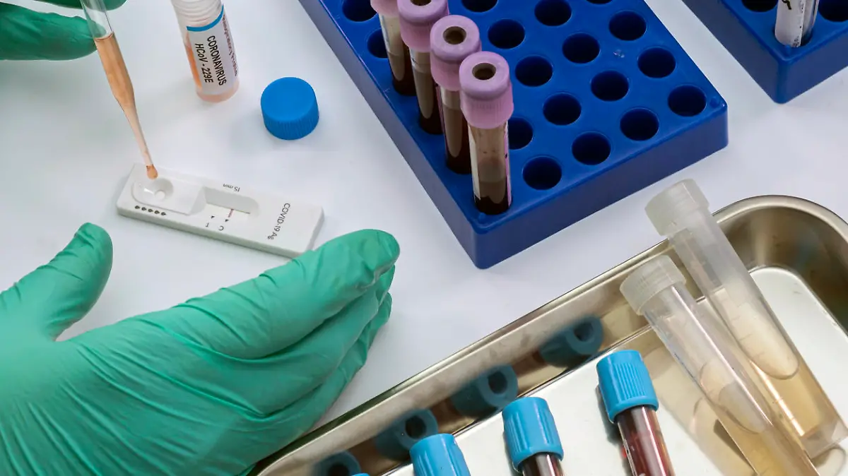 Nurse analyses positive PCR test of covid-19 in a hospital laboratory, conceptual image