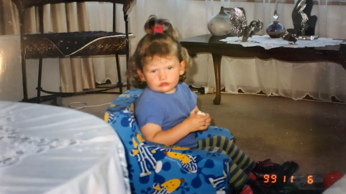Story from Jam Press (Cannot Smile)

Pictured: Taylor Clement aged 2.

Woman born with extremely rare condition that means she can't SMILE becomes Instagram star

Meet the woman born with a one in four million condition which means she can't smile.

Tayla Clement, 24, from Christchurch, New Zealand, has spent her entire life unable to move her eyes from left to right, raise her eyebrows or her upper lip due to Moebius syndrome.

She was born with the condition, which is characterised by weakening or paralysis of muscles in the face used to control expression and eye movements.

The neurological disorder has no cure but the symptoms can be treated. 

"It’s not always been easy," Tayla, who has 18,400 followers on Instagram, told Jam Press. 

"I’ve spent many years hating my smile, wishing I had a 'normal' smile, wishing I just didn’t exist because that seemed easier than being alive, but by some miracle, I’m still here.

"I now know I was born to stand out. 

"I was born to make a difference in this world and I know that whole-heartedly.  

"My syndrome and not being able to smile is the greatest gift I could have ever been given, it has allowed me to already help and inspire so many people."

Tayla underwent facial reanimation surgery aged 12 in the hope of restoring voluntary movement in her face.

The corrective procedure – often referred to as a 'smile operation' – saw doctors transplant soft tissue from her thigh to both sides of her face, in a bid to grant her the ability to clench her mouth to mimic a smile.

But the eight-hour procedure was unsuccessful and left devastated Tayla with a completely swollen and bruised face.

Her condition saw her bullied throughout her time at school – where she was called "ugly" on a daily basis and claims to have had sheep poo thrown at her.

The experiences saw her diagnosed with severe clinical depression and anxiety with PTSD and dissociative attacks at the age of 18.

Tayla said: "Things really began to get