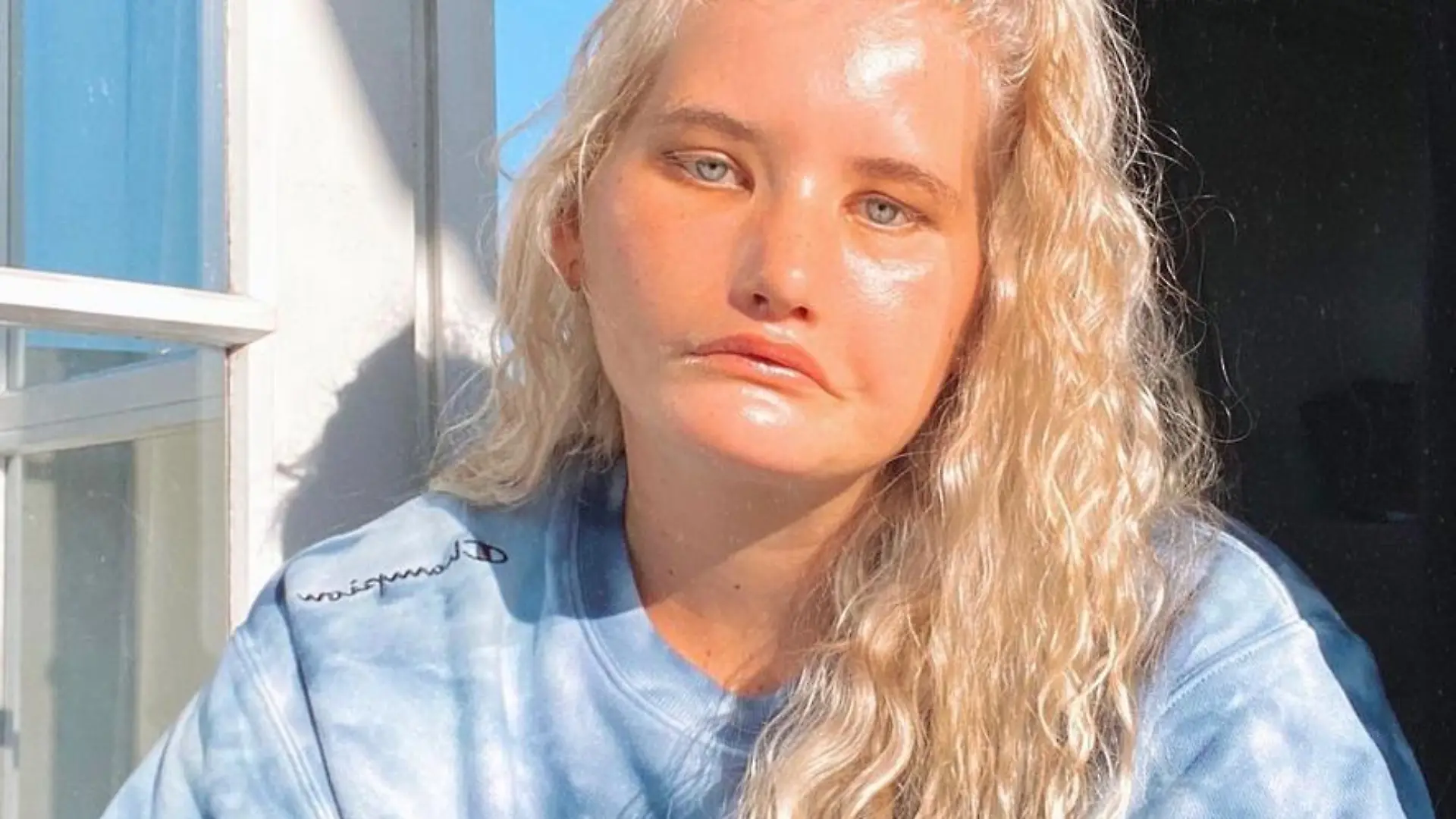 Story from Jam Press (Cannot Smile)
Pictured: Taylor Clement.
Woman born with extremely rare condition that means she can't SMILE becomes Instagram star
Meet the woman born with a one in four million condition which means she can't smile.
Tayla Clement, 24, from Christchurch, New Zealand, has spent her entire life unable to move her eyes from left to right, raise her eyebrows or her upper lip due to Moebius syndrome.
She was born with the condition, which is characterised by weakening or paralysis of muscles in the face used to control expression and eye movements.
The neurological disorder has no cure but the symptoms can be treated.
"It’s not always been easy," Tayla, who has 18,400 followers on Instagram, told Jam Press.
"I’ve spent many years hating my smile, wishing I had a 'normal' smile, wishing I just didn’t exist because that seemed easier than being alive, but by some miracle, I’m still here.
"I now know I was born to stand out.
"I was born to make a difference in this world and I know that whole-heartedly.
"My syndrome and not being able to smile is the greatest gift I could have ever been given, it has allowed me to already help and inspire so many people."
Tayla underwent facial reanimation surgery aged 12 in the hope of restoring voluntary movement in her face.
The corrective procedure – often referred to as a 'smile operation' – saw doctors transplant soft tissue from her thigh to both sides of her face, in a bid to grant her the ability to clench her mouth to mimic a smile.
But the eight-hour procedure was unsuccessful and left devastated Tayla with a completely swollen and bruised face.
Her condition saw her bullied throughout her time at school – where she was called "ugly" on a daily basis and claims to have had sheep poo thrown at her.
The experiences saw her diagnosed with severe clinical depression and anxiety with PTSD and dissociative attacks at the age of 18.
Tayla said: "Things really began to get worse.