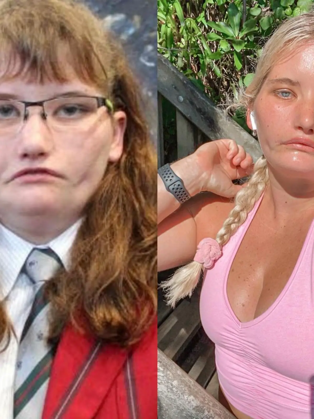 Story from Jam Press (Cannot Smile)

Pictured: Taylor Clement at school aged 17 (L) and now (R).

Woman born with extremely rare condition that means she can't SMILE becomes Instagram star

Meet the woman born with a one in four million condition which means she can't smile.

Tayla Clement, 24, from Christchurch, New Zealand, has spent her entire life unable to move her eyes from left to right, raise her eyebrows or her upper lip due to Moebius syndrome.

She was born with the condition, which is characterised by weakening or paralysis of muscles in the face used to control expression and eye movements.

The neurological disorder has no cure but the symptoms can be treated. 

"It’s not always been easy," Tayla, who has 18,400 followers on Instagram, told Jam Press. 

"I’ve spent many years hating my smile, wishing I had a 'normal' smile, wishing I just didn’t exist because that seemed easier than being alive, but by some miracle, I’m still here.

"I now know I was born to stand out. 

"I was born to make a difference in this world and I know that whole-heartedly.  

"My syndrome and not being able to smile is the greatest gift I could have ever been given, it has allowed me to already help and inspire so many people."

Tayla underwent facial reanimation surgery aged 12 in the hope of restoring voluntary movement in her face.

The corrective procedure – often referred to as a 'smile operation' – saw doctors transplant soft tissue from her thigh to both sides of her face, in a bid to grant her the ability to clench her mouth to mimic a smile.

But the eight-hour procedure was unsuccessful and left devastated Tayla with a completely swollen and bruised face.

Her condition saw her bullied throughout her time at school – where she was called "ugly" on a daily basis and claims to have had sheep poo thrown at her.

The experiences saw her diagnosed with severe clinical depression and anxiety with PTSD and dissociative attacks at the age of 18.

Tayla said: 