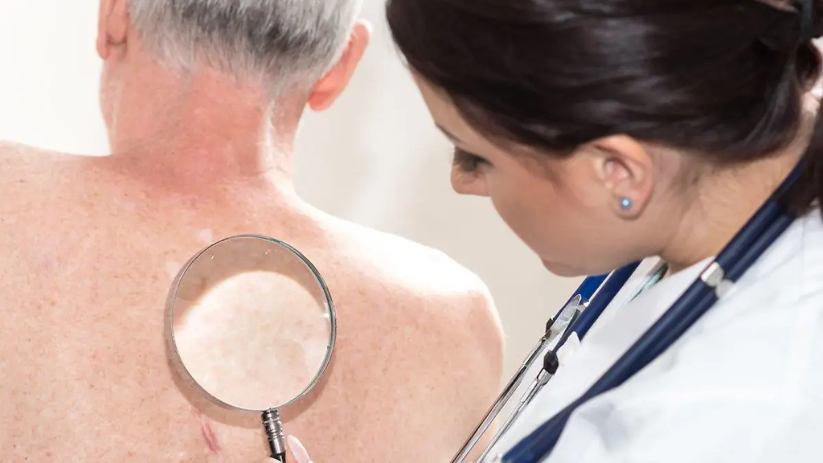Gürtelrose: Expertin klärt über Erreger und Symptome auf