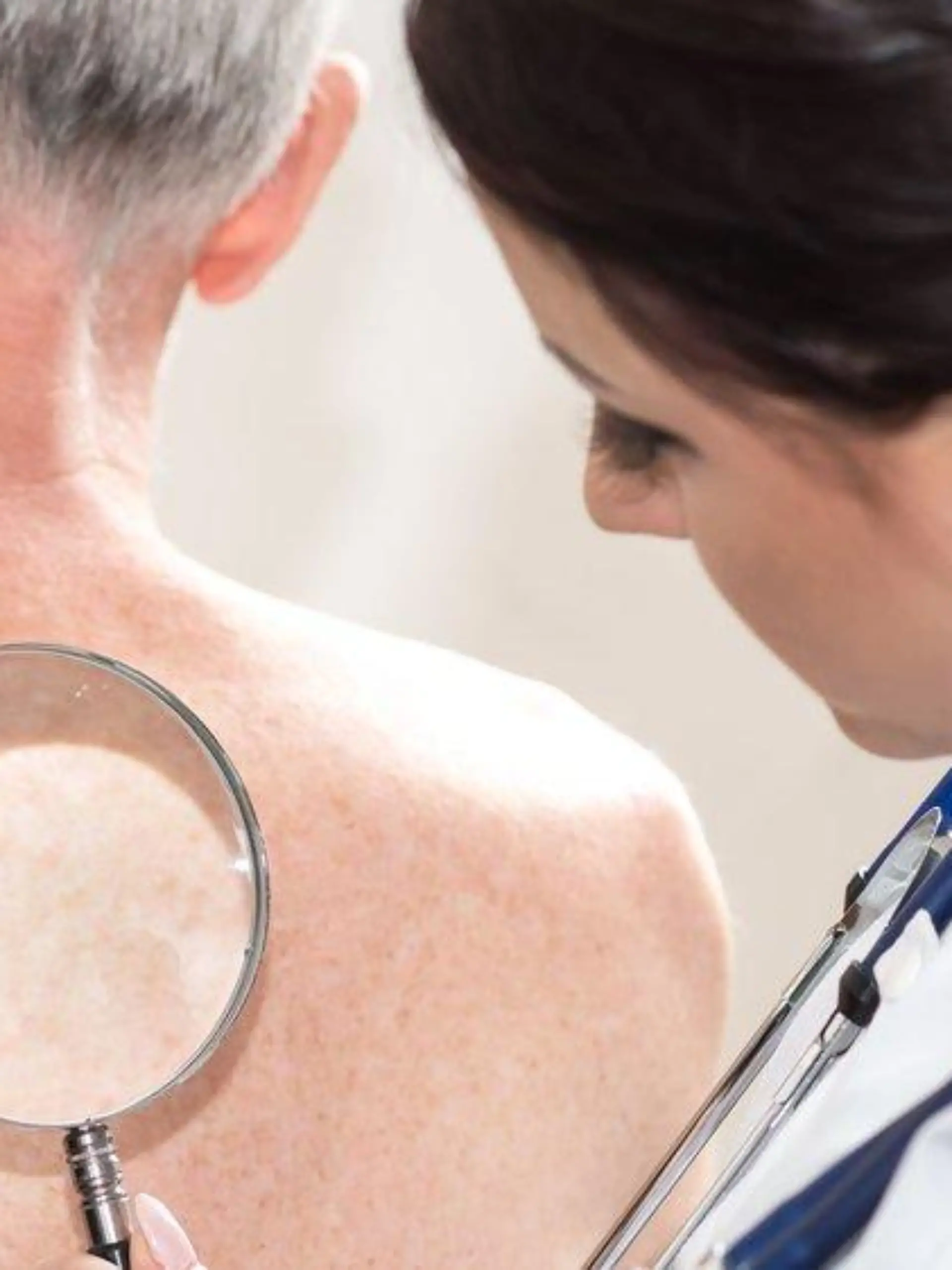 Gürtelrose: Expertin klärt über Erreger und Symptome auf