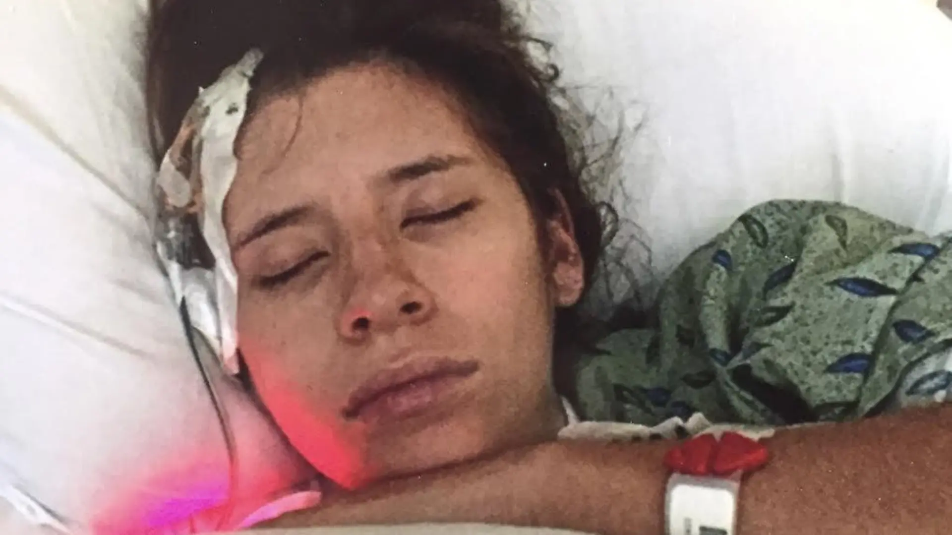 Story from Jam Press (Brain Pop Stroke)
Pictured: Bridget in hospital after the stroke.
Mum reveals how her brain 'popped' and caused a stroke as she picked up her daughter on a hike
A mum has revealed how she suffered a stroke when a blood vessel in her brain popped as she bent down to pick up her daughter.
Bridget Chiovari, 30, from Arizona, US, was on a hike with friends and their children but they stopped for a break and she took her 18-month-old daughter Liliana out of her carrier.
As the mum, who also was 24 weeks pregnant with her second child at the time, went to put Liliana back in the carrier, she felt a pop sensation in her head.
"Immediately after I felt the 'pop' I was hit by some intense dizziness and a horrific headache," she told Jam Press.
She managed to hike home and thought it would go away.
Later that evening, with the headache getting worse, her husband Chris, 33, took her to hospital.
She said: "I told them I felt a pop, and then an awful headache.
"I even said 'I've never had a brain aneurysm before but I imagine that this is what it must feel like.'
"They hooked me up to an IV bag, gave me some Tylenol, told me it was dehydration, then sent me home to 'sleep it off'.
"Within 12 minutes of leaving the hospital, I had lost my ability to form words."
Returning to the hospital, her husband demanded a CT scan which showed Bridget actually had an arteriovenous malformation - a tangle of abnormal blood vessels which had become so tangled, one had burst, causing a massive stroke.
Bridget had been born with the ticking time-bomb and had no idea it was there until the moment it popped.
Bridget said: "I had an interventricular drain placed into my skull. This allows that excess blood and fluids to leave your body while they wait for the swelling of the brain to go down. This is the part that saved my life."
The mum didn't even know that what was happened was a stroke until she joined a Facebook group for other AVM surviours and someone e