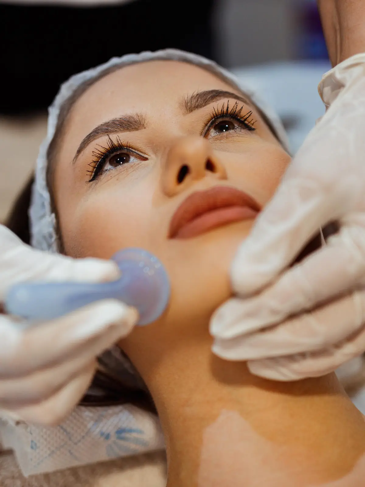Beautiful young woman lying down in the beauty clinic and having a facial cupping massage treatment to stimulate blood circulation