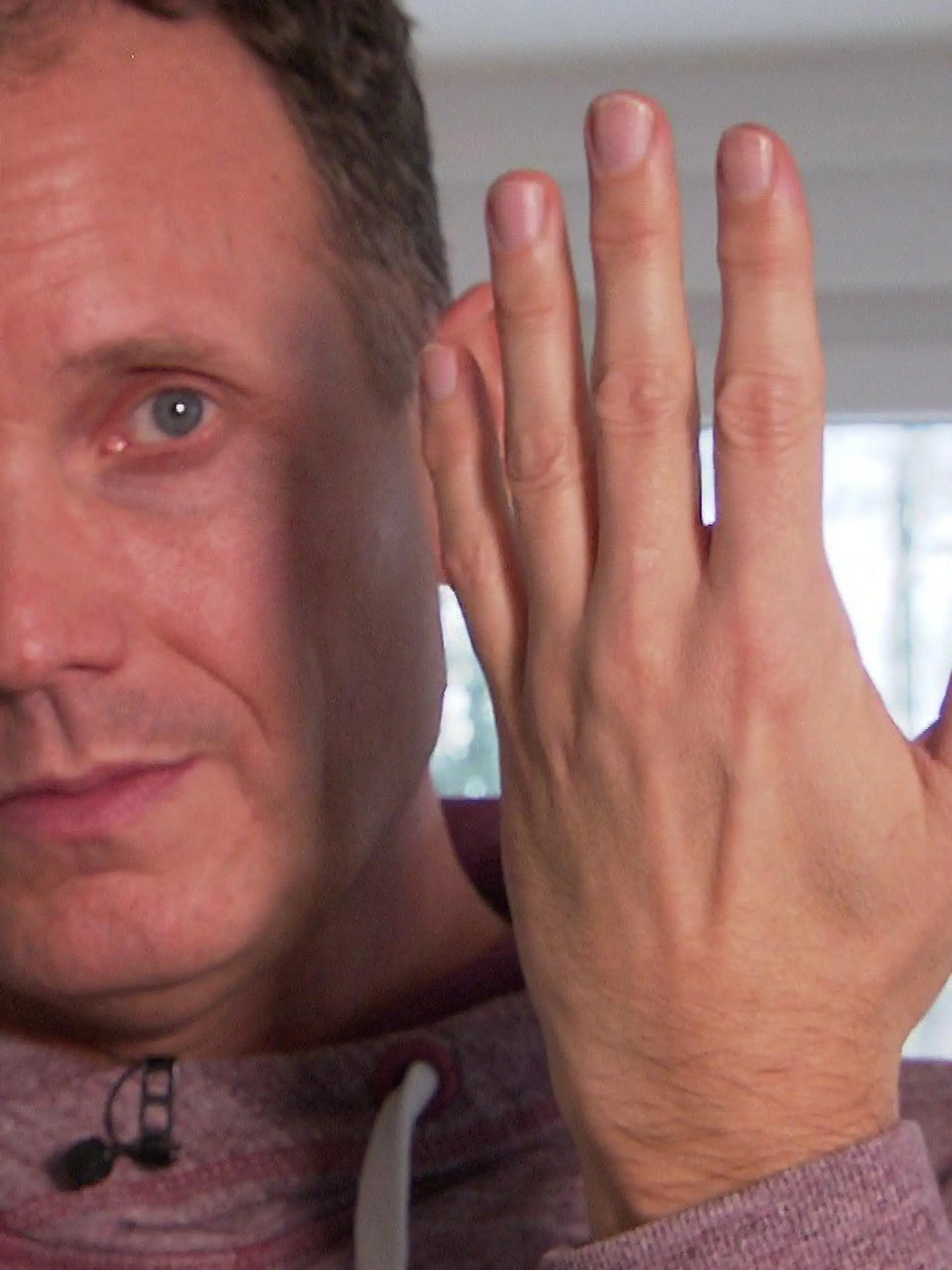 Patrick Kramer hat in jeder Hand drei Implantate versteckt.