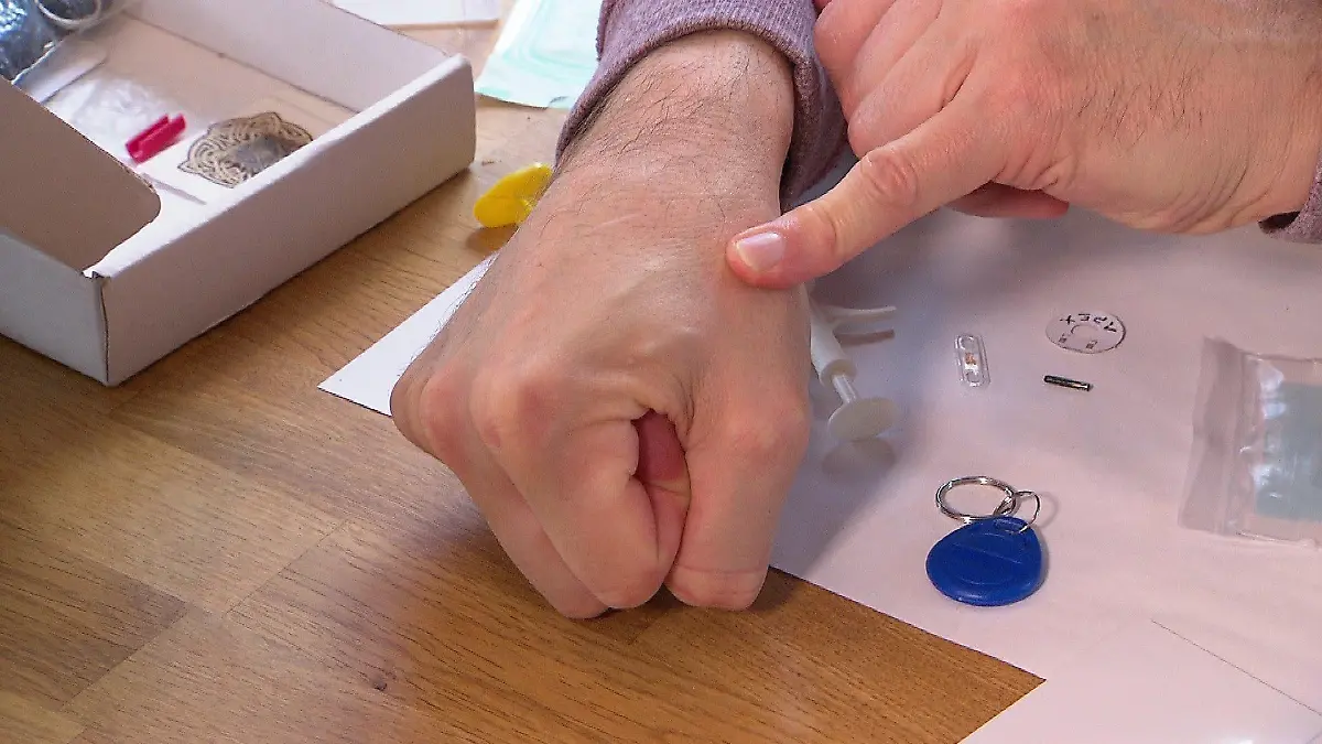 Drei Mikrochip-Implantate - ein flaches ist nicht einmal sichtbar,