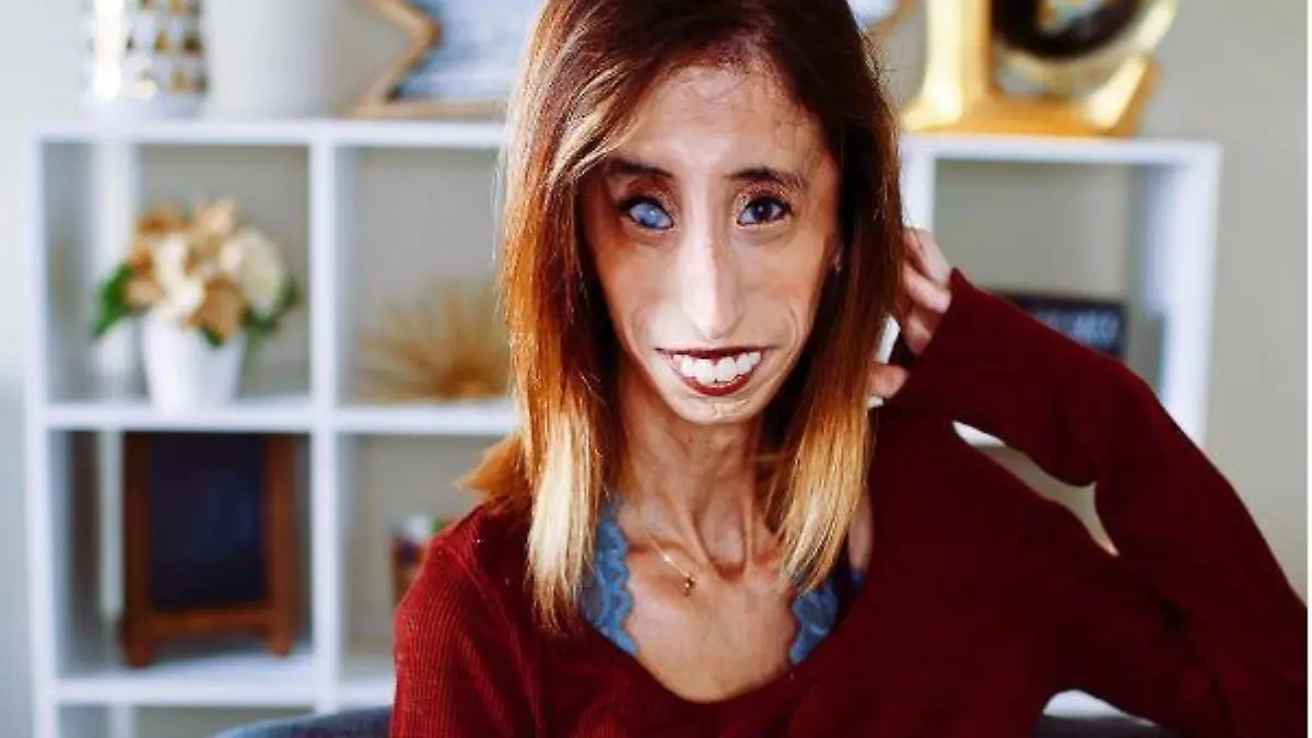 Lizzie Velasquez