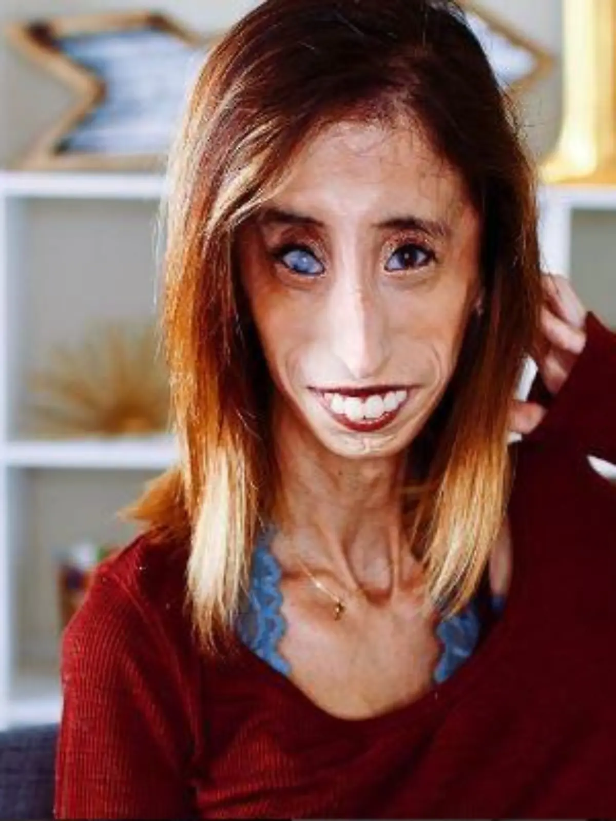 Lizzie Velasquez