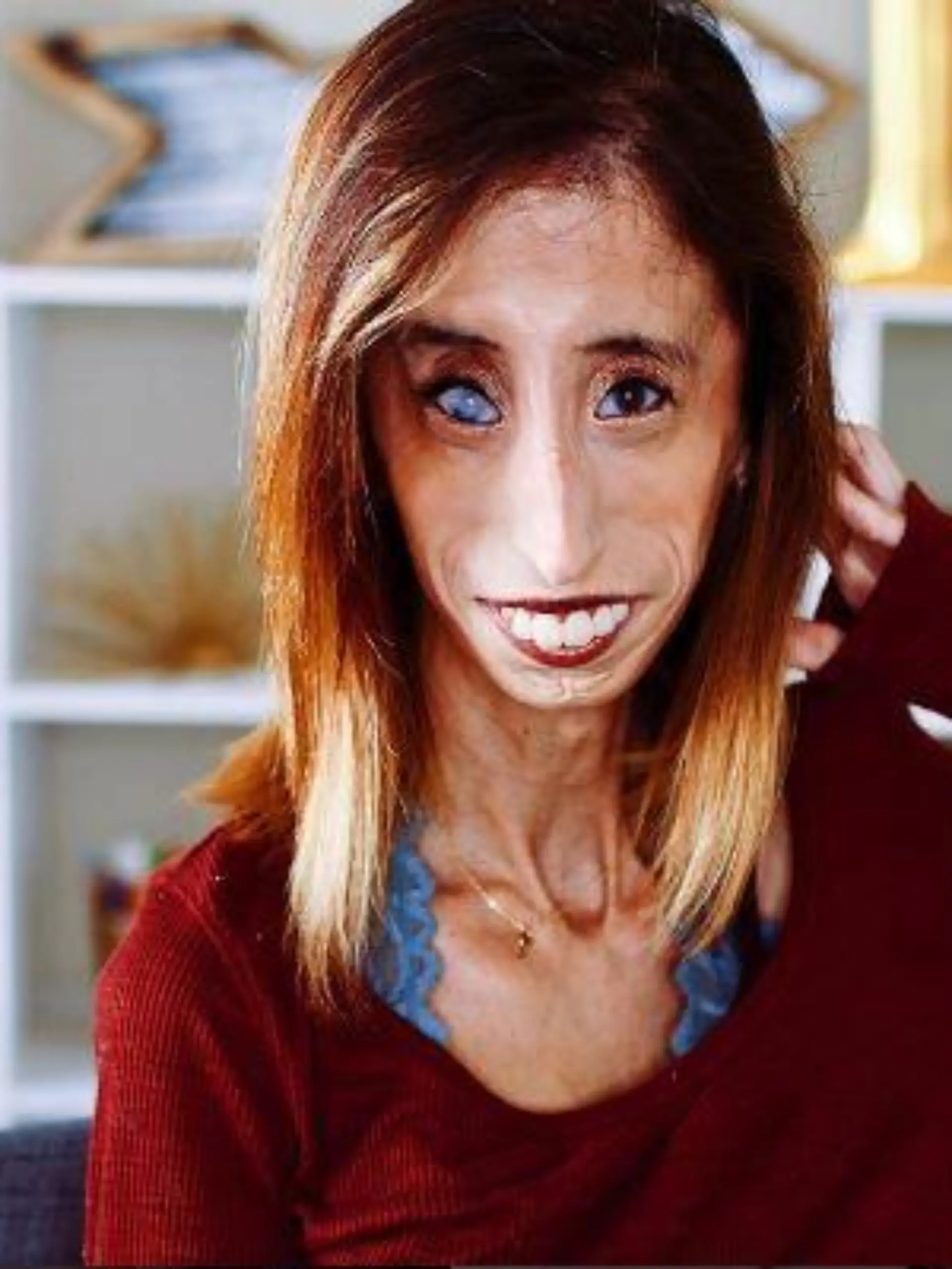 Lizzie Velasquez