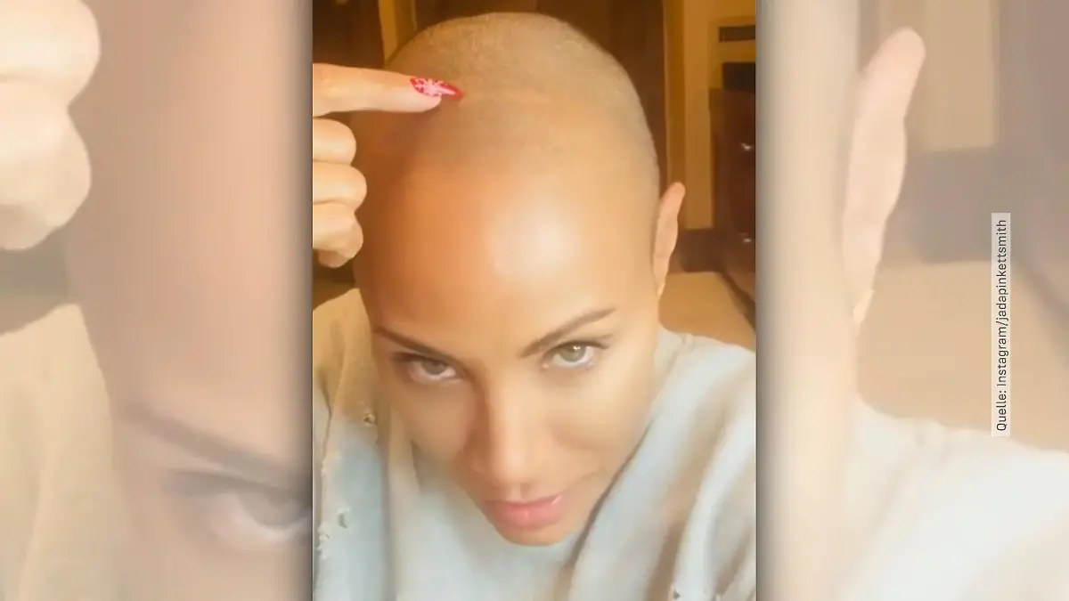 Jada Pinkett Smith lebt selbstbewusst mit Haarausfall Schauspielerin offenbart sich