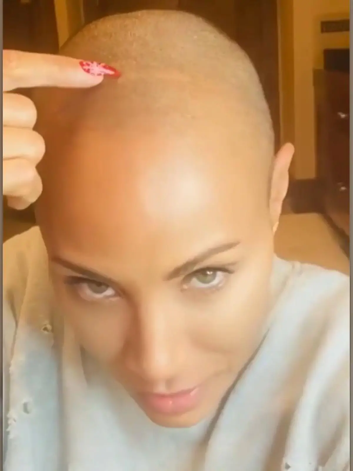 Bild zu: "Jada Pinkett Smith lebt selbstbewusst mit Haarausfall"
